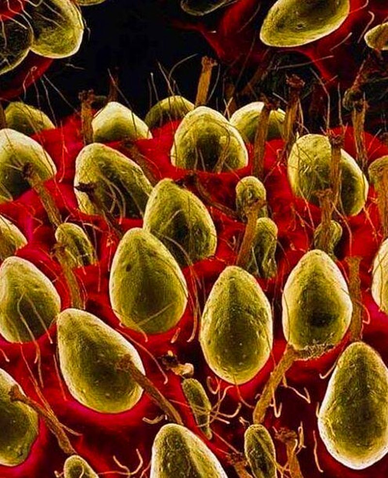 Strawberries Under The Microscope