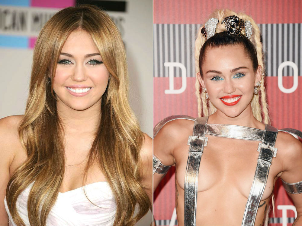 Top 10 Dramatic Celebrity Transformations for Better or Worse