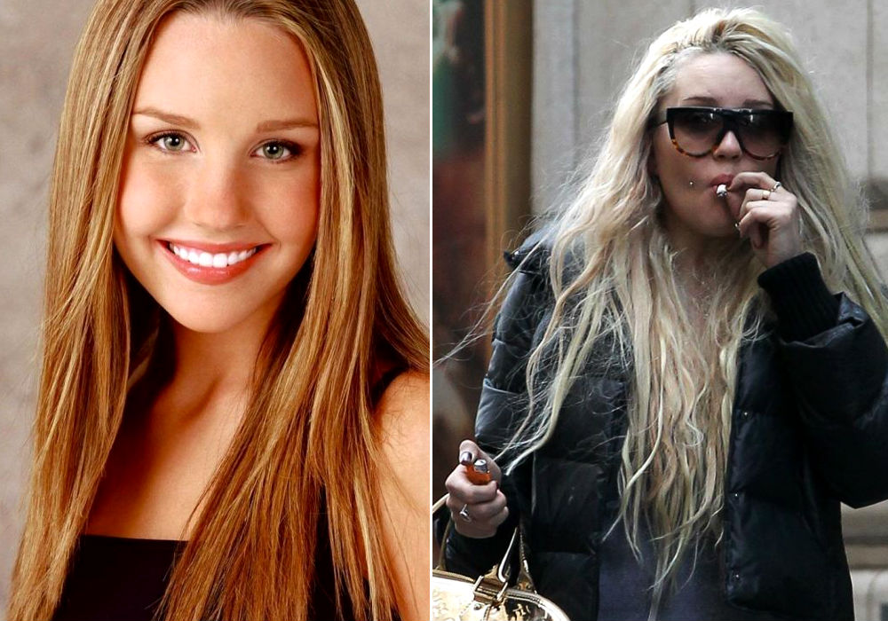 Top 10 Dramatic Celebrity Transformations for Better or Worse