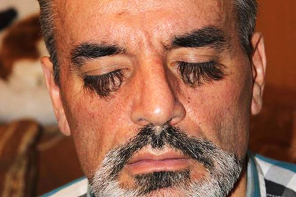 These 9 People Have Won World Records For Their Longest Body Parts