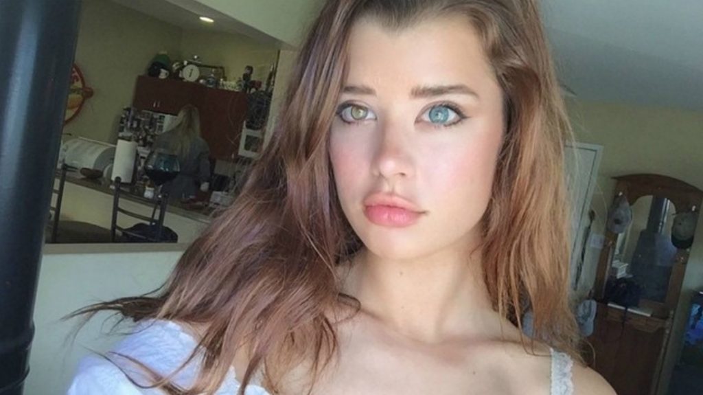 Beautiful Mutations: 15 Staggering Photos of Heterochromia