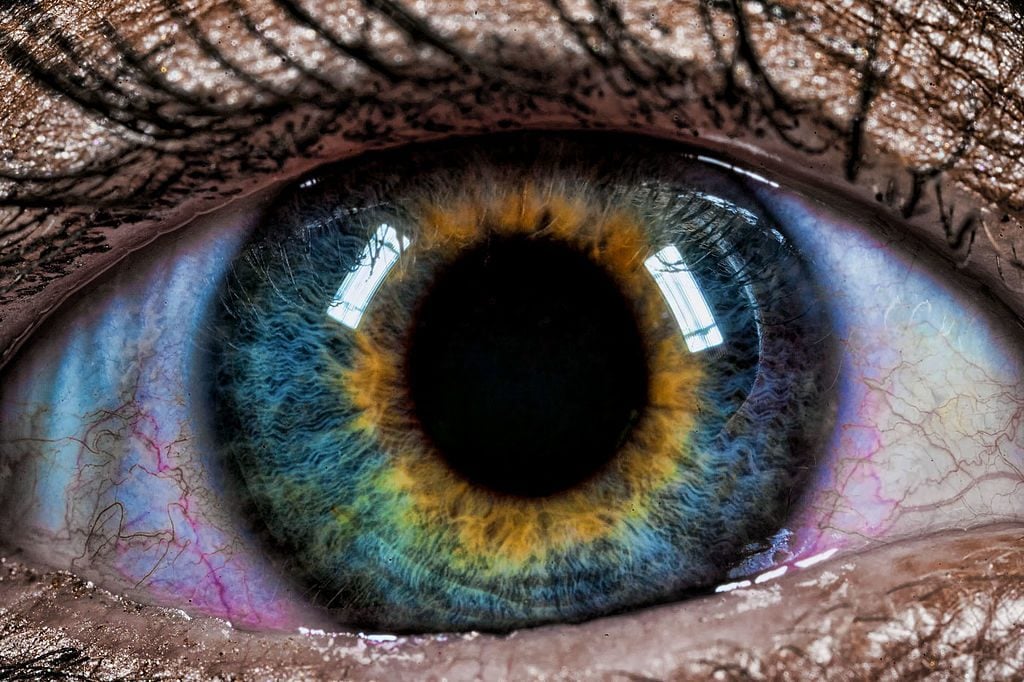 Beautiful Mutations: 15 Staggering Photos of Heterochromia