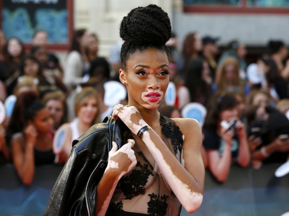 9 Models Who Changed The Definition of Beauty in Their Favor