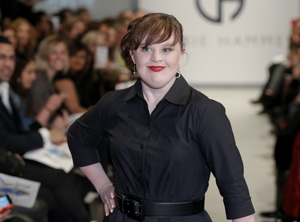 9 Models Who Changed The Definition of Beauty in Their Favor