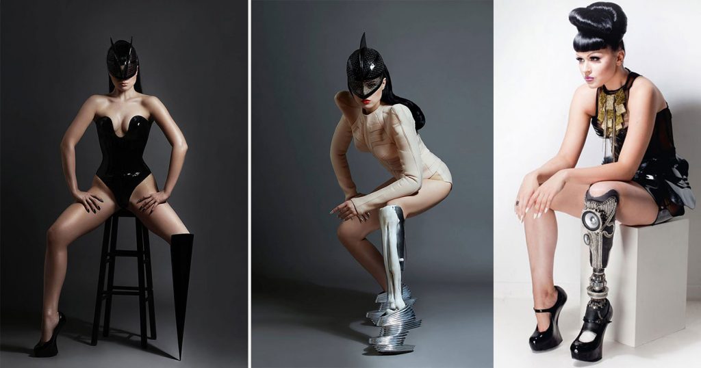 9 Models Who Changed The Definition of Beauty in Their Favor