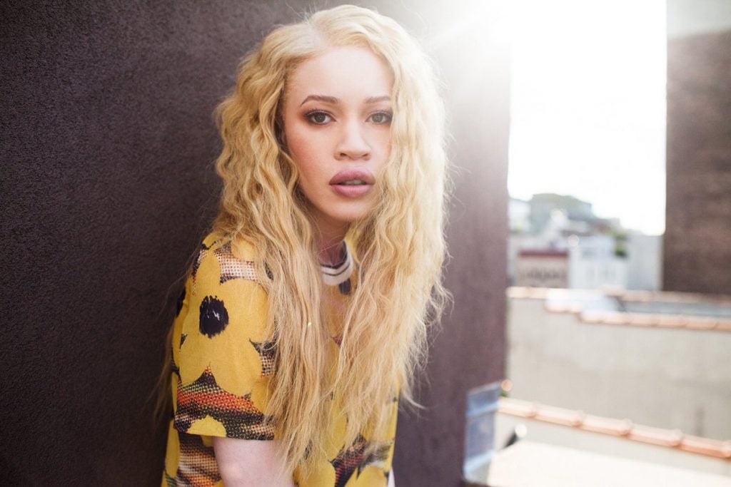 9 Models Who Changed The Definition of Beauty in Their Favor