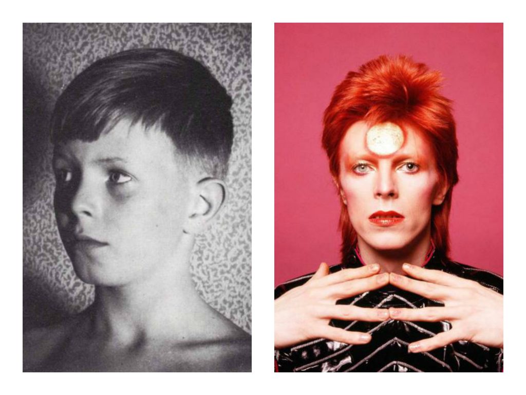 Do You Recognize These Baby Faces? (33 Pics)