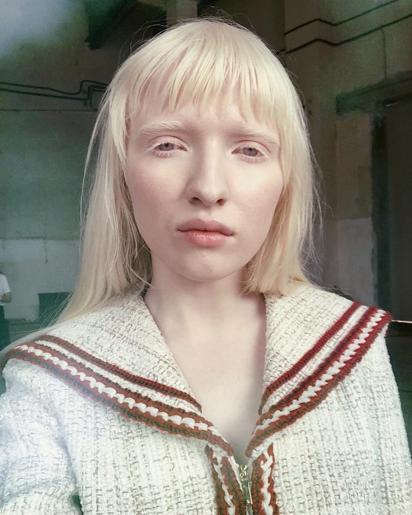 10 Unique People Who Will Hypnotize You With Their Appearance