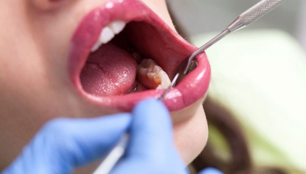 9 Body Parts Humans Don’t Really Need