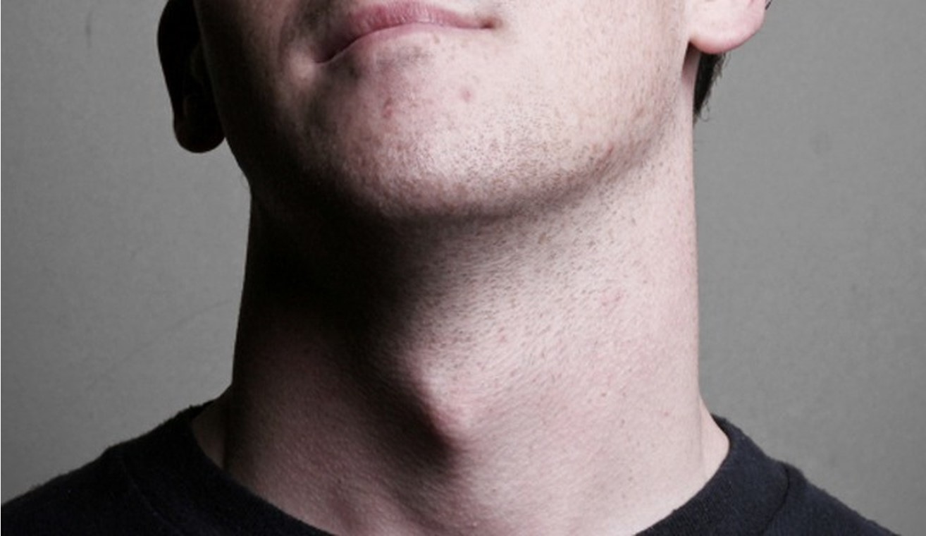 Щитовидный хрящ | 8 фактов о мужском теле, которые заставят вас по-новому взглянуть на сильный пол | Brain Berries