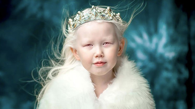 6 Of The Most Unusual Kids In The World | Zestradar
