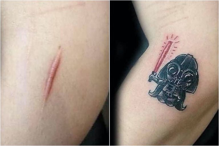 15 Creative Scar Tattoo Cover Ups