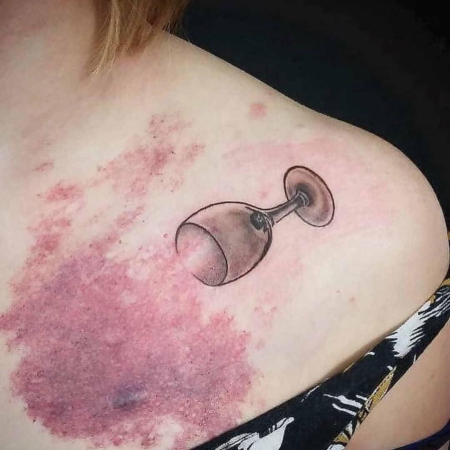 15 Creative Scar Tattoo Cover Ups