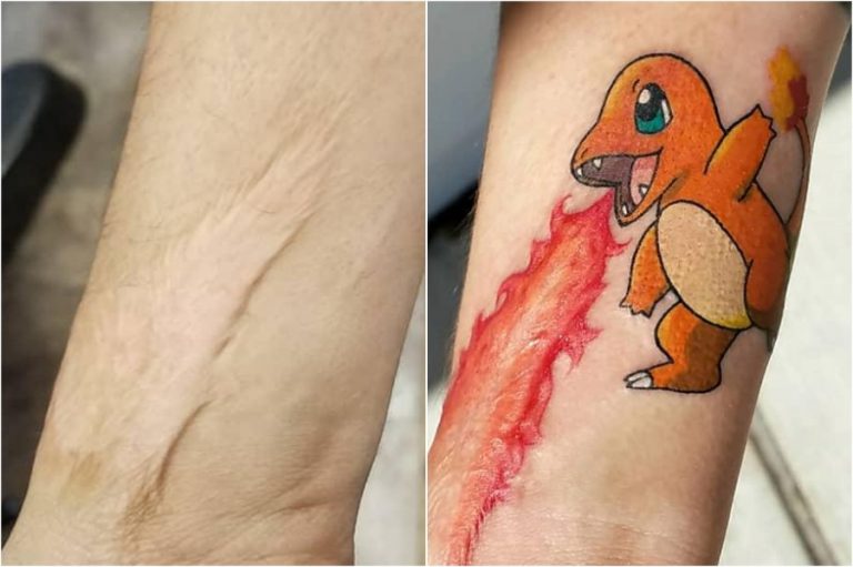 ≡ 15 Creative Scar Tattoo Cover Ups Brain Berries