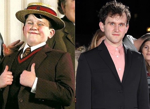 Harry Melling as Dudley Dursley | The Cast of Harry Potter: Then and Now | Zestradar