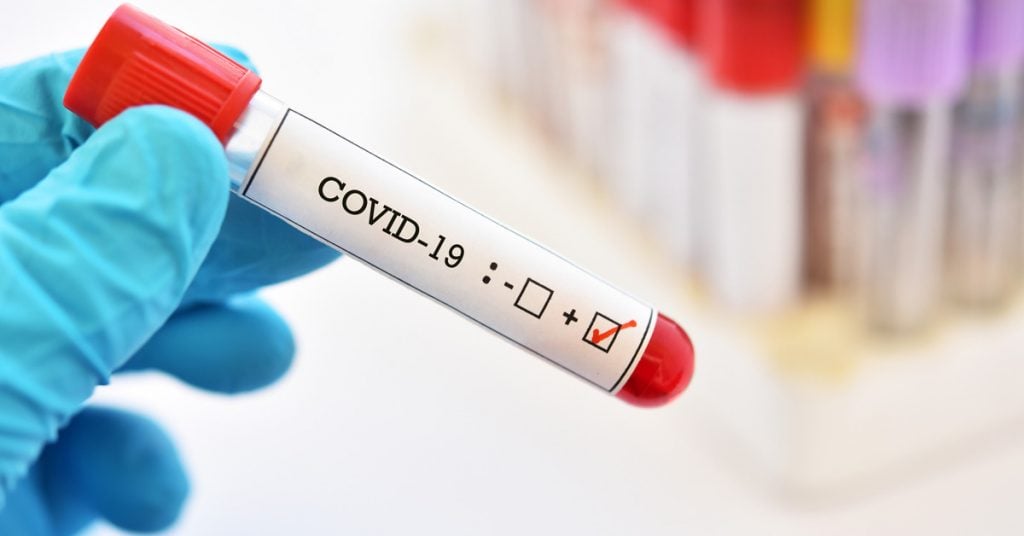 Covid-19 đã làm thay đổi lối sống như thế nào?