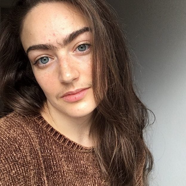 This Woman Stopped Removing Facial Hair For A Year, Here’s How it