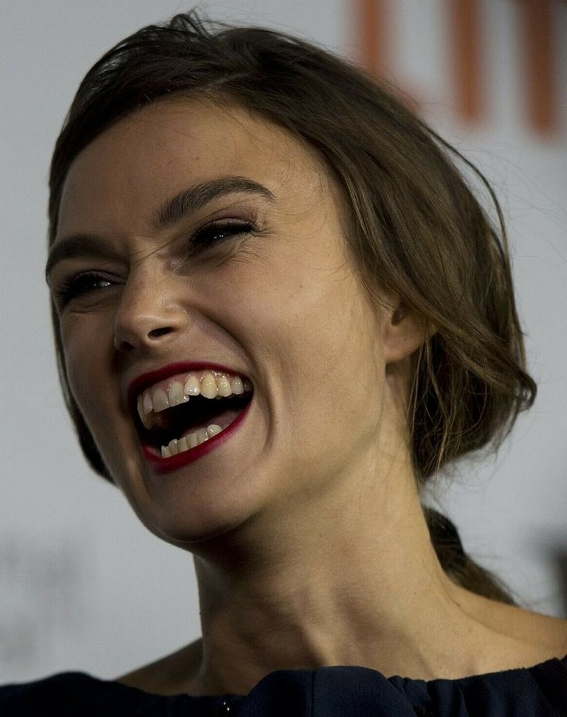 Celebrities Who Embraced Their Perfectly Imperfect Smiles