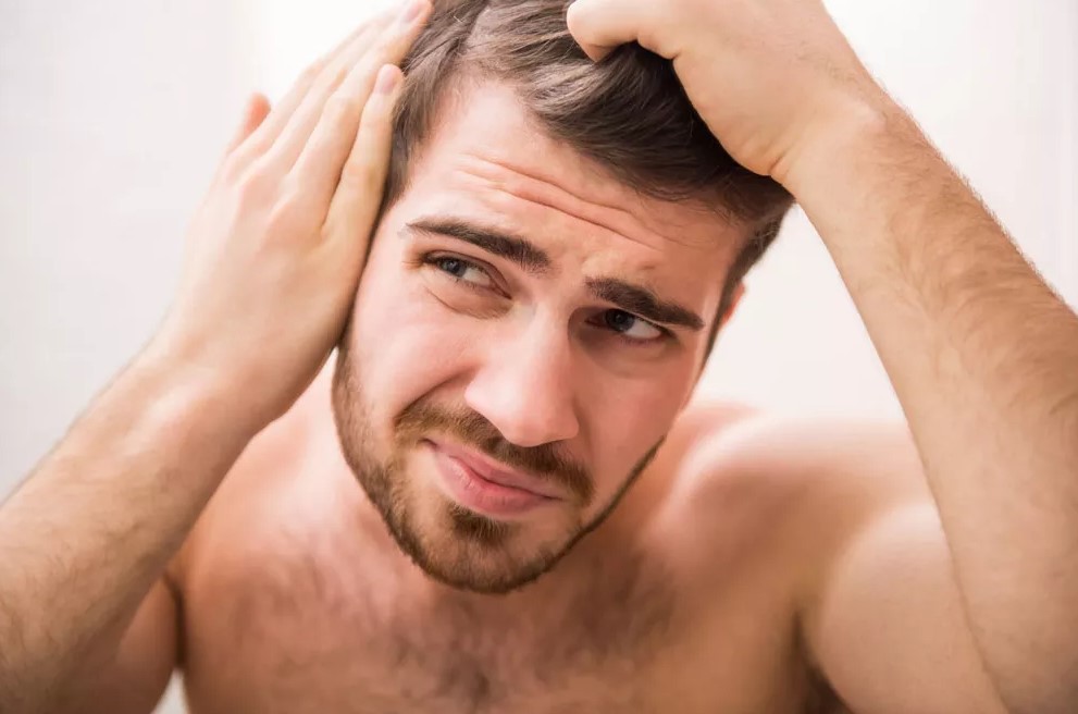 Sobre implante e transplante capilar para homens