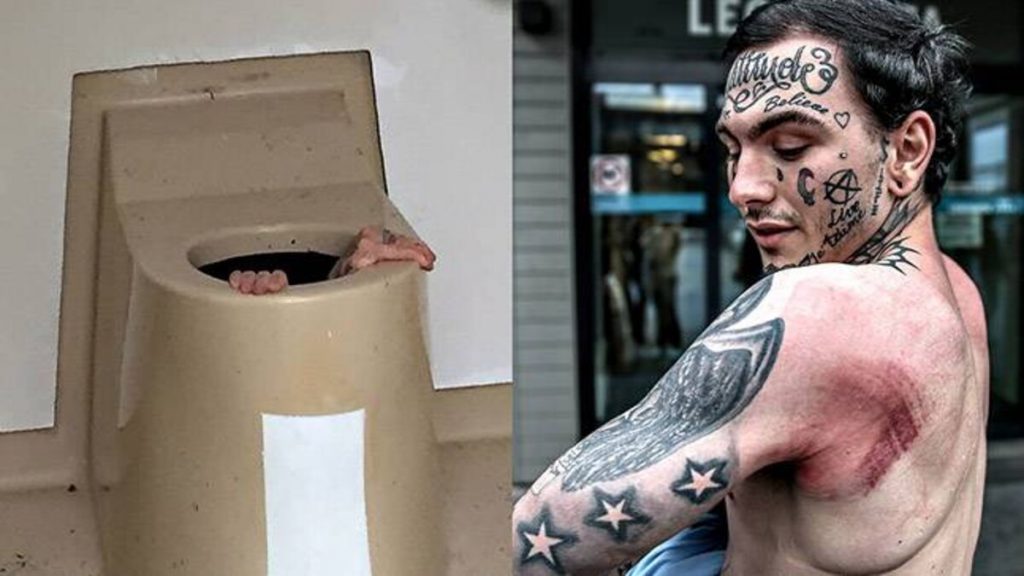 8 Times People Got Stuck In Weird Places