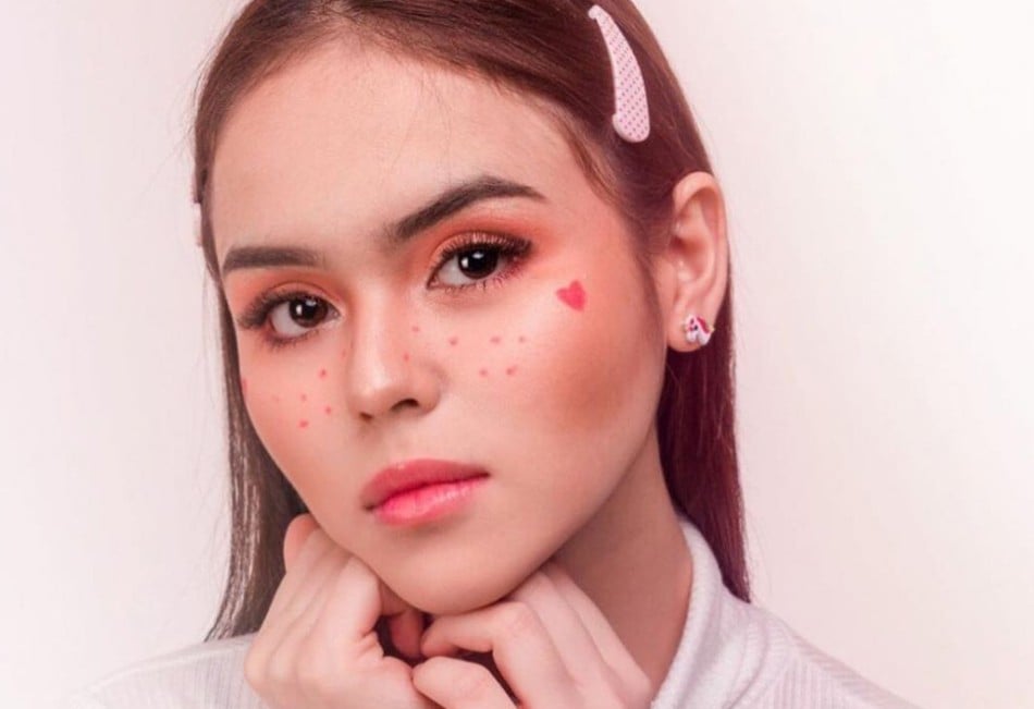 8 Fakta Laura Anna, Selebgram Muda Yang Alami Kecelakaan Tragis