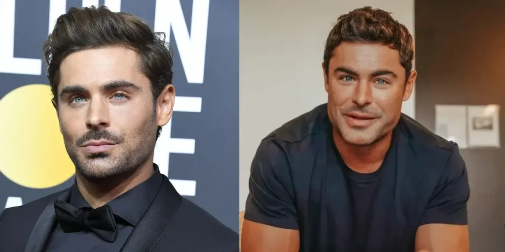 Fans Are Worried About Zac Efron’s New Face