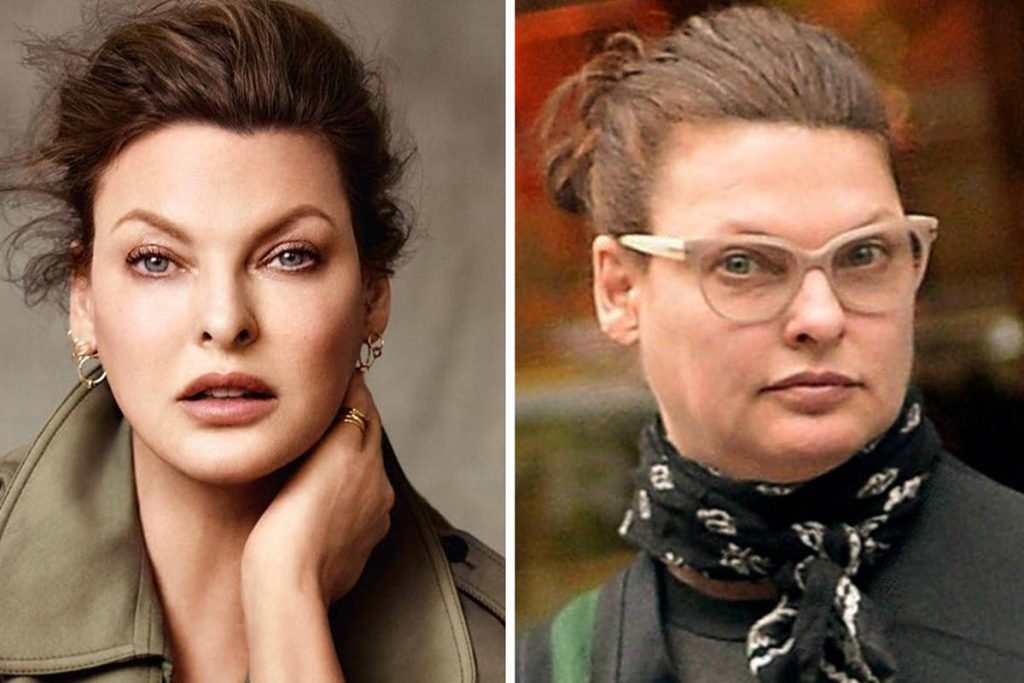 10 famosas que se arrepienten de sus cirugías estéticas