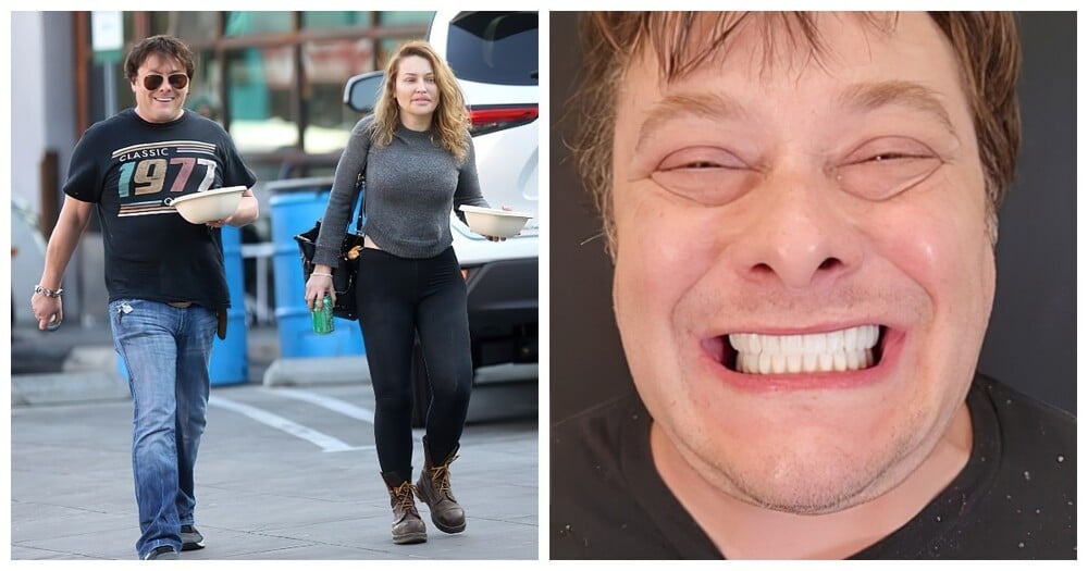 John Connor from “Terminator 2” Is Unrecognizable After Replacing His Rotted Teeth