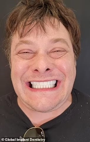 John Connor from “Terminator 2” Is Unrecognizable After Replacing His Rotted Teeth
