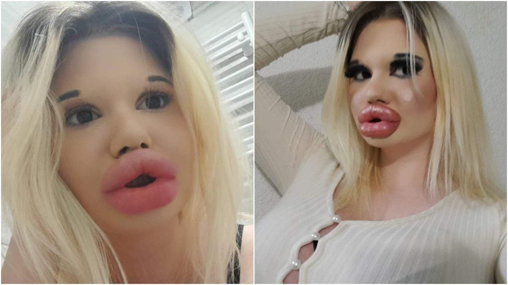 Lată-o pe Andrea Ivanova, femeia bulgară care susține că are cele mai mari buze din lume!