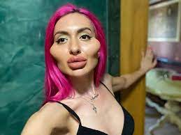 أدمنت عمليات التجميل: من هي عارضة الأزياء الأوكرانية أناستاسيا بوكريشوك؟