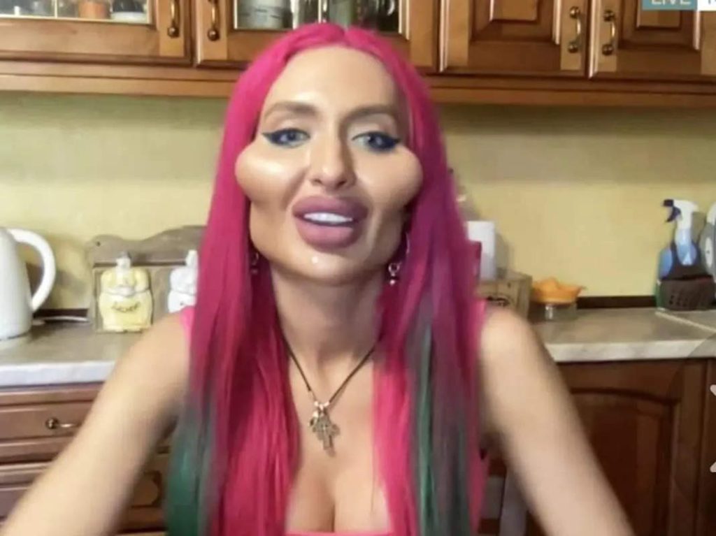 أدمنت عمليات التجميل: من هي عارضة الأزياء الأوكرانية أناستاسيا بوكريشوك؟