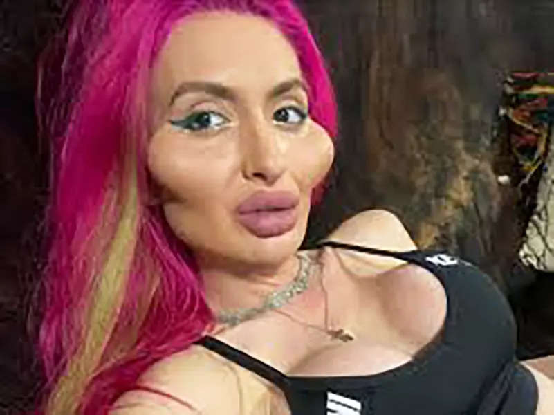 أدمنت عمليات التجميل: من هي عارضة الأزياء الأوكرانية أناستاسيا بوكريشوك؟