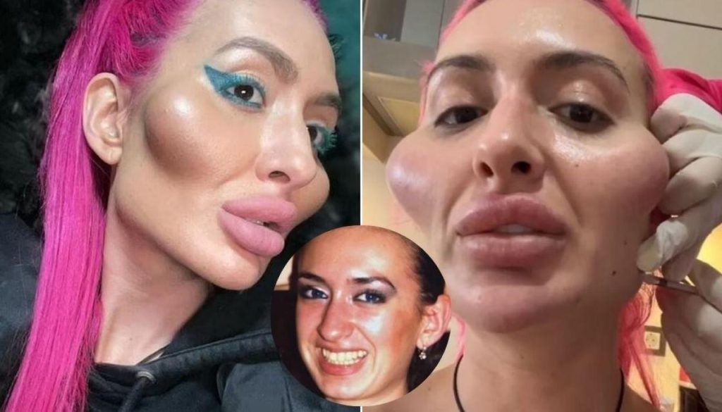 أدمنت عمليات التجميل: من هي عارضة الأزياء الأوكرانية أناستاسيا بوكريشوك؟