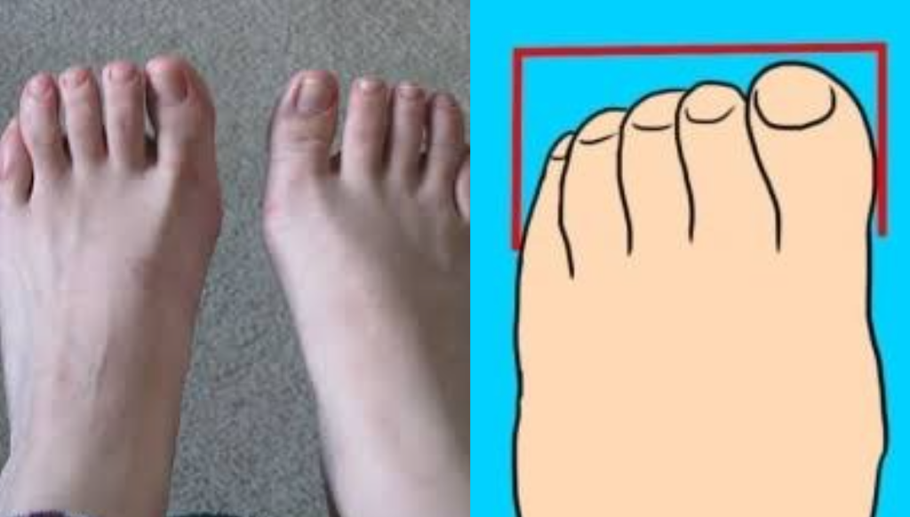 Hình dạng bàn chân tiết lộ tính cách gì của bạn?