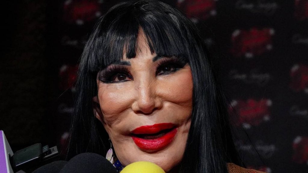 10 famosas latinas que sufrieron por sus cirugías plásticas